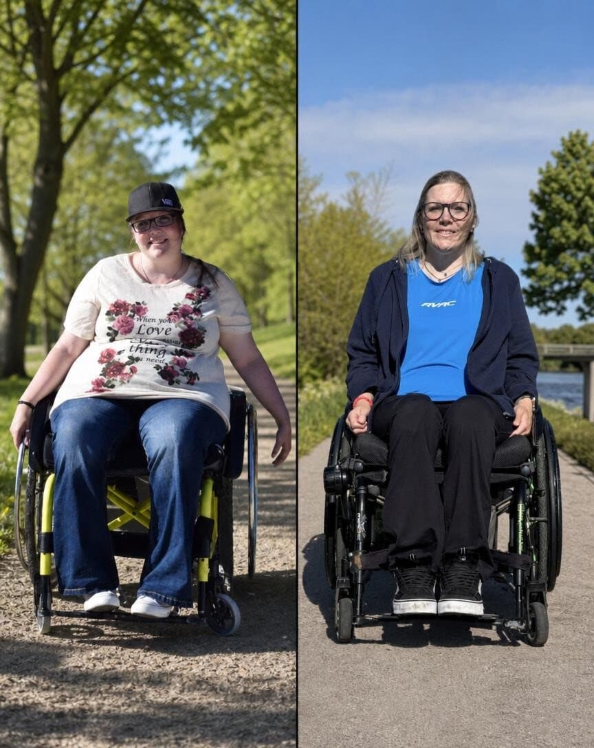 Vorher-Nachher-Transformation einer Kundin im Rollstuhl, deutlich schlanker