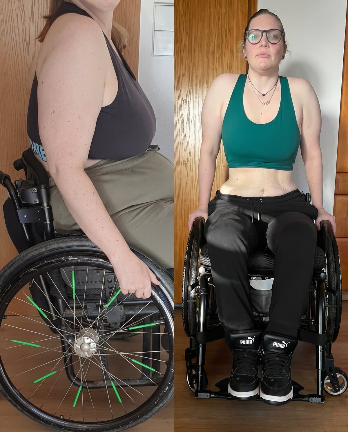 Vorher-Nachher-Transformation in der Rückenansicht einer Kundin, straffer