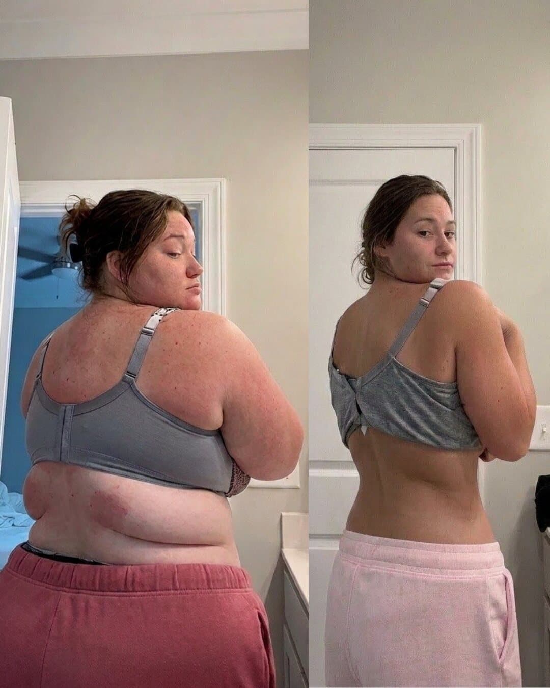 Vorher-Nachher-Transformation einer Kundin von hinten, deutlich schlanker