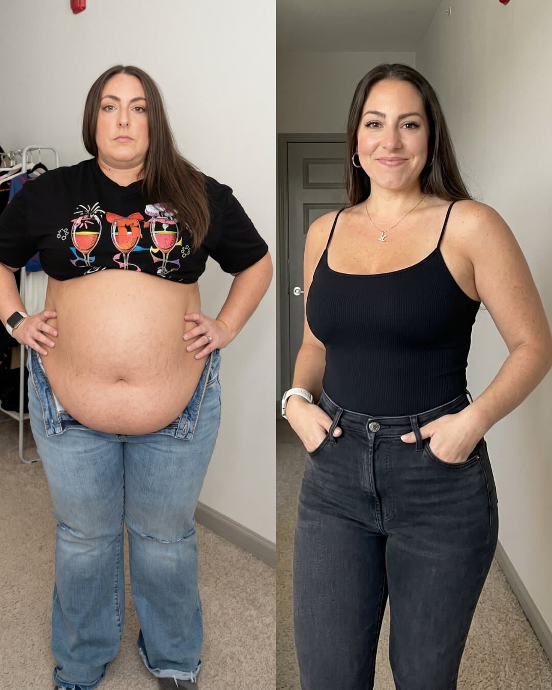 Vorher-Nachher-Transformation einer Kundin in schwarzem Top und Jeans, sichtbar flacherer Bauch